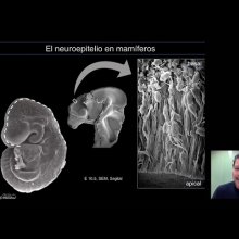 "Diferencias en la división de células madre cerebrales entre seres humanos modernos y neandertales"
